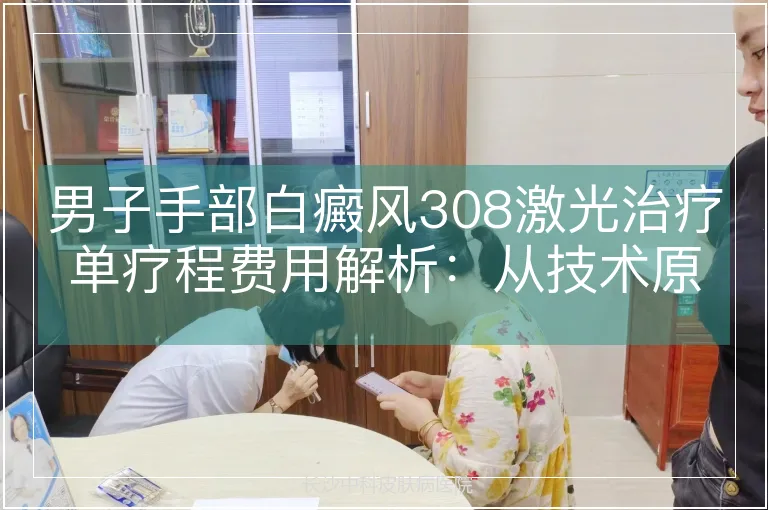 男子手部白癜风308激光治疗单疗程费用解析：从技术原理到成本构成的全维度分析