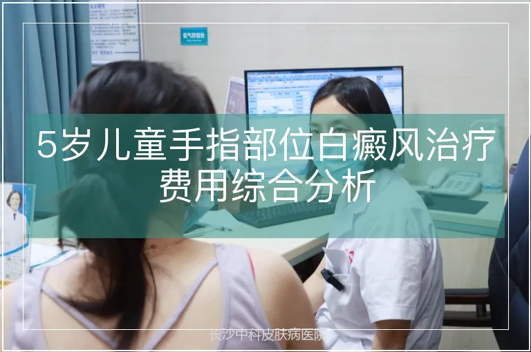 5岁儿童手指部位白癜风治疗费用综合分析