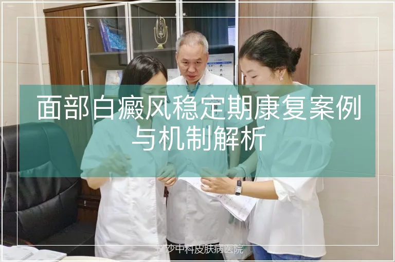 面部白癜风稳定期康复案例与机制解析