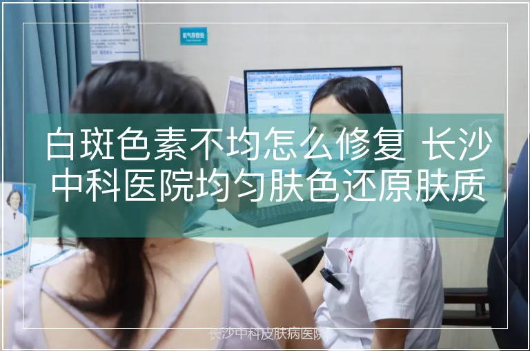 白斑色素不均怎么修复 长沙中科医院均匀肤色还原肤质