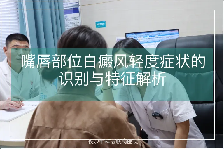 嘴唇部位白癜风轻度症状的识别与特征解析