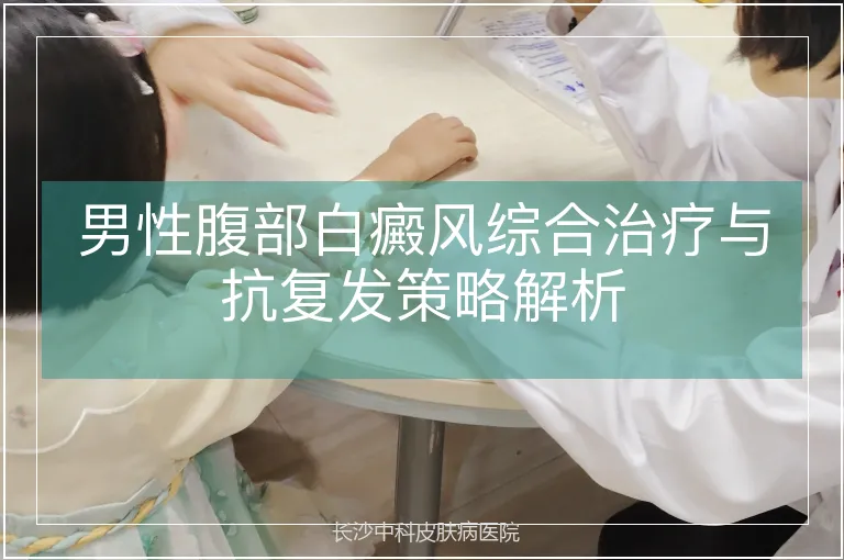 男性腹部白癜风综合治疗与抗复发策略解析