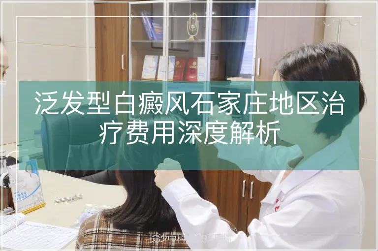 泛发型白癜风石家庄地区治疗费用深度解析