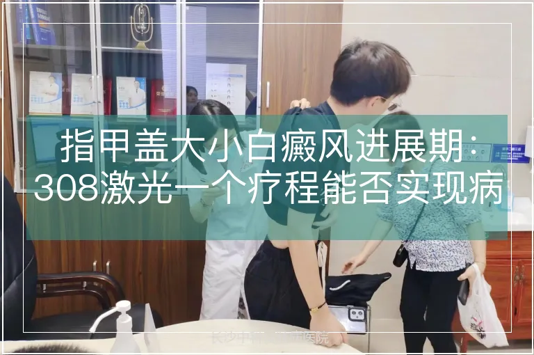 指甲盖大小白癜风进展期：308激光一个疗程能否实现病情控制？