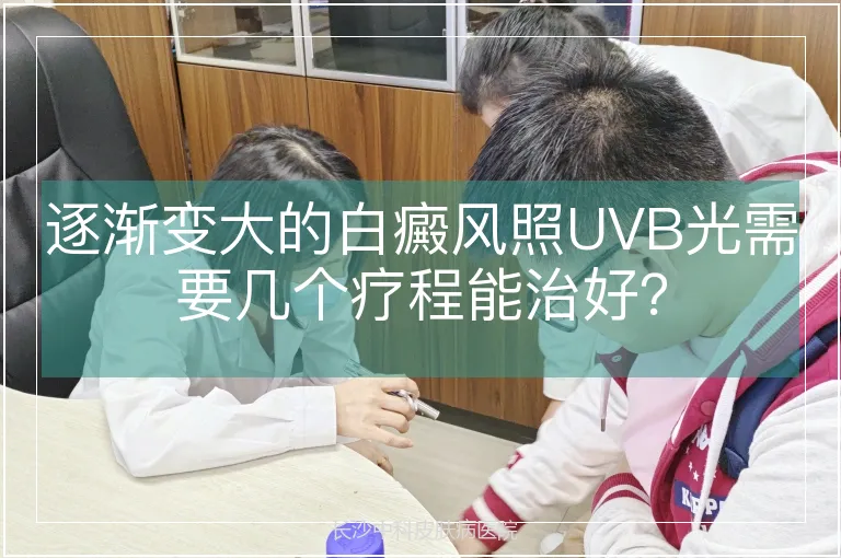 逐渐变大的白癜风照UVB光需要几个疗程能治好？