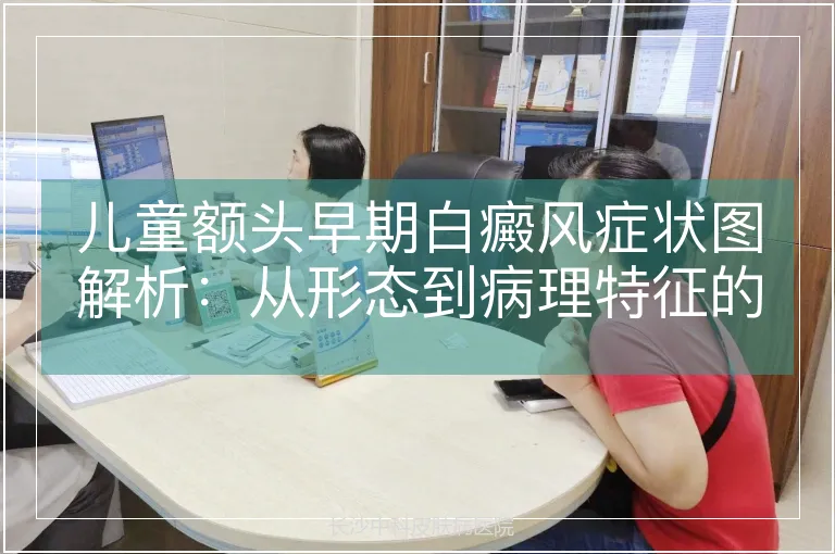 儿童额头早期白癜风症状图解析：从形态到病理特征的专业解读