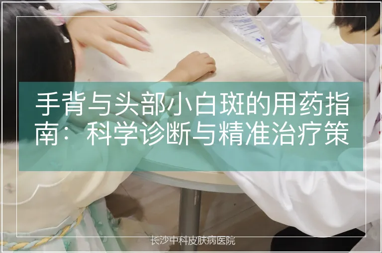 手背与头部小白斑的用药指南：科学诊断与精准治疗策略