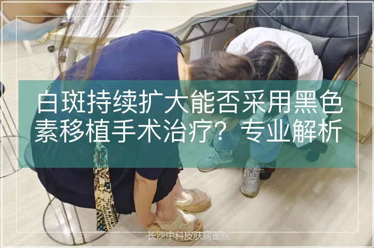 白斑持续扩大能否采用黑色素移植手术治疗？专业解析与临床决策依据