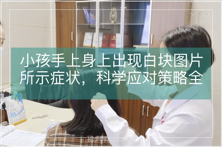 小孩手上身上出现白块图片所示症状，科学应对策略全解析