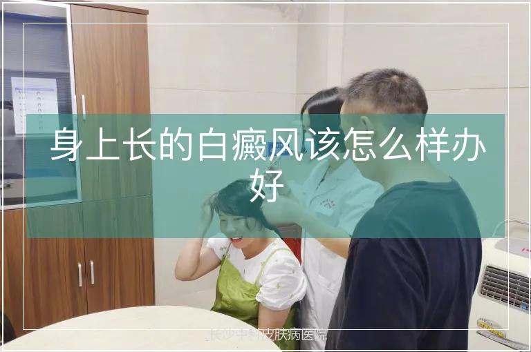 身上长的白癜风该怎么样办好