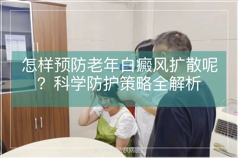 怎样预防老年白癜风扩散呢？科学防护策略全解析