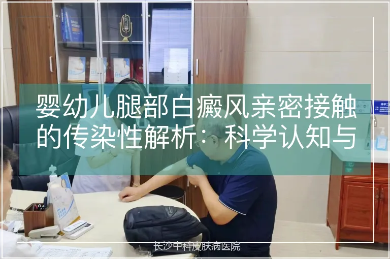 婴幼儿腿部白癜风亲密接触的传染性解析：科学认知与防护指南