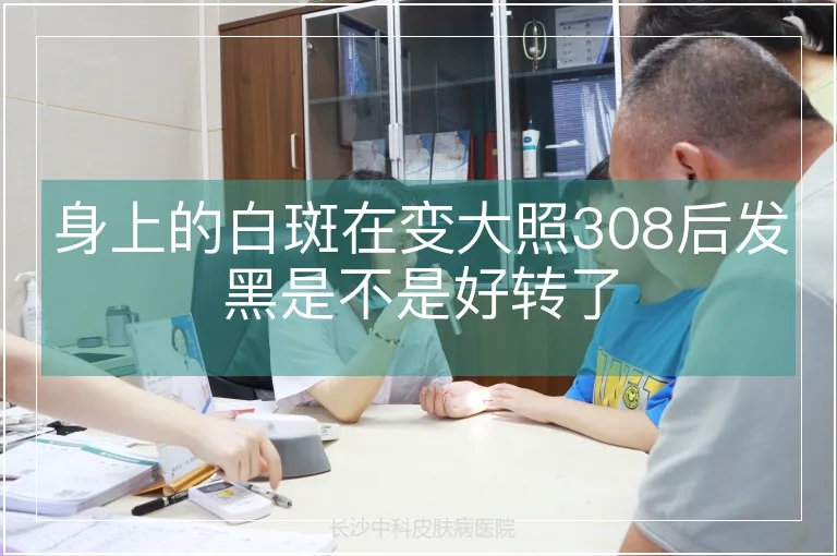 身上的白斑在变大照308后发黑是不是好转了