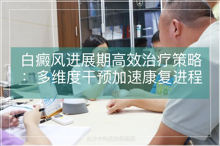 白癜风进展期高效治疗策略：多维度干预加速康复进程