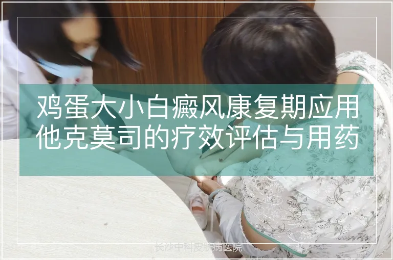鸡蛋大小白癜风康复期应用他克莫司的疗效评估与用药频率优化