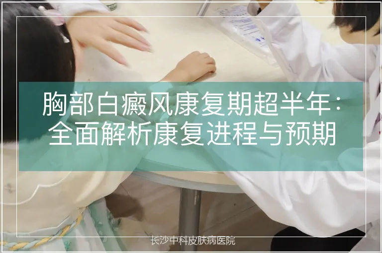 胸部白癜风康复期超半年：全面解析康复进程与预期