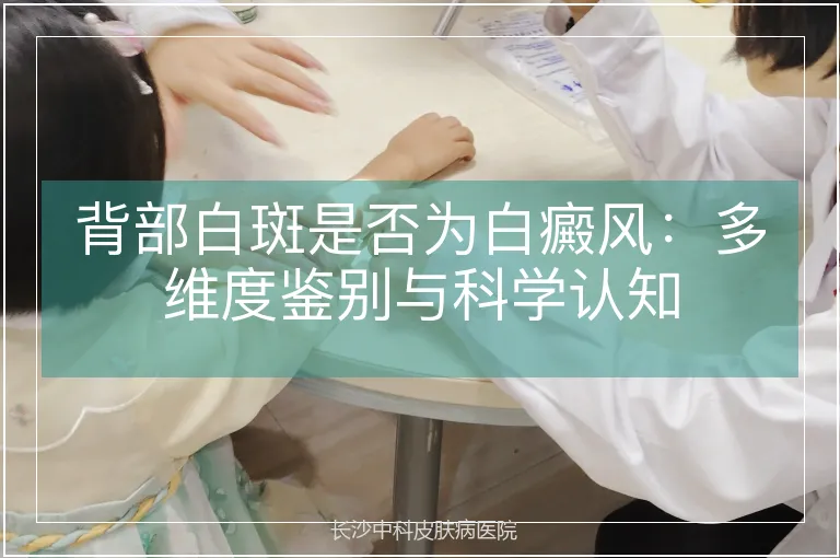 背部白斑是否为白癜风：多维度鉴别与科学认知