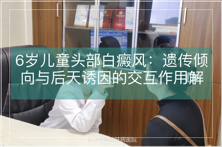 6岁儿童头部白癜风：遗传倾向与后天诱因的交互作用解析