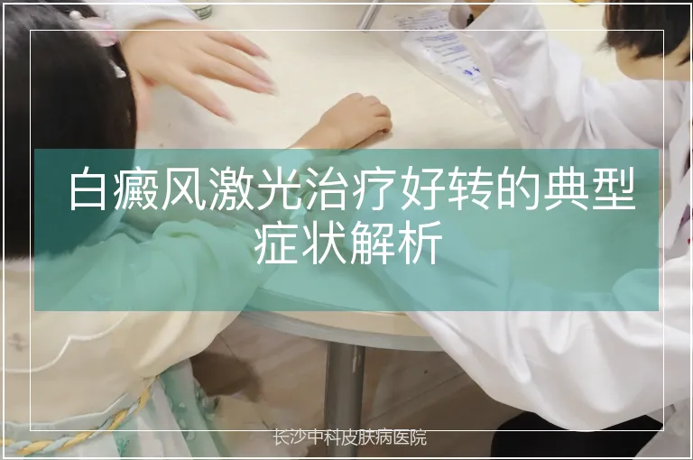白癜风激光治疗好转的典型症状解析