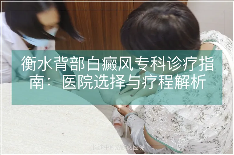 衡水背部白癜风专科诊疗指南：医院选择与疗程解析