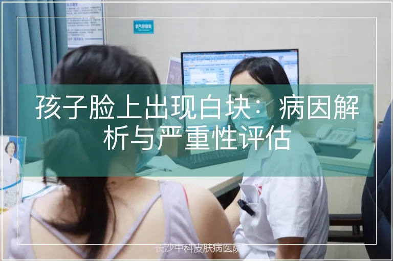 孩子脸上出现白块：病因解析与严重性评估