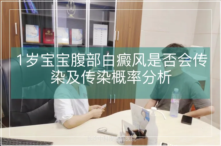 1岁宝宝腹部白癜风是否会传染及传染概率分析