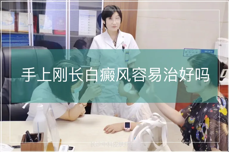 手上刚长白癜风容易治好吗