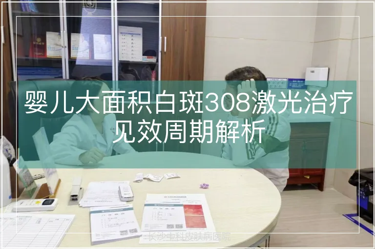 婴儿大面积白斑308激光治疗见效周期解析