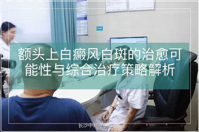 额头上白癜风白斑的治愈可能性与综合治疗策略解析