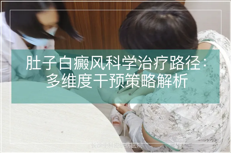 肚子白癜风科学治疗路径：多维度干预策略解析