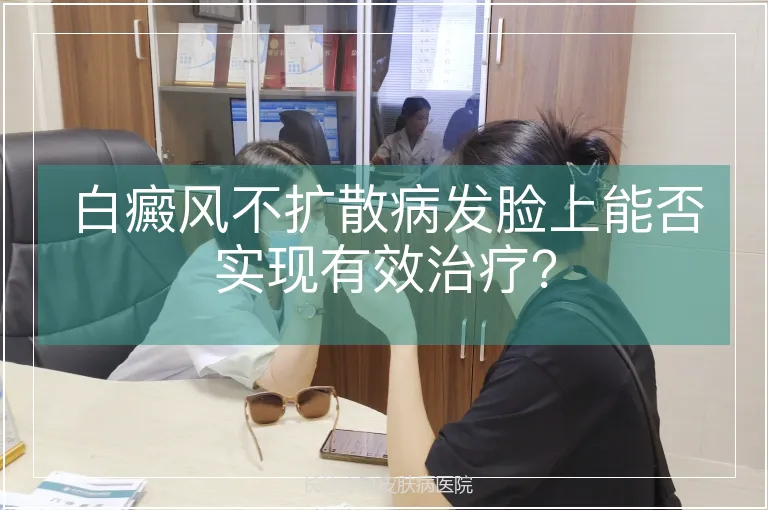 白癜风不扩散病发脸上能否实现有效治疗？