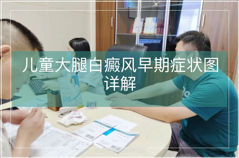 儿童大腿白癜风早期症状图详解