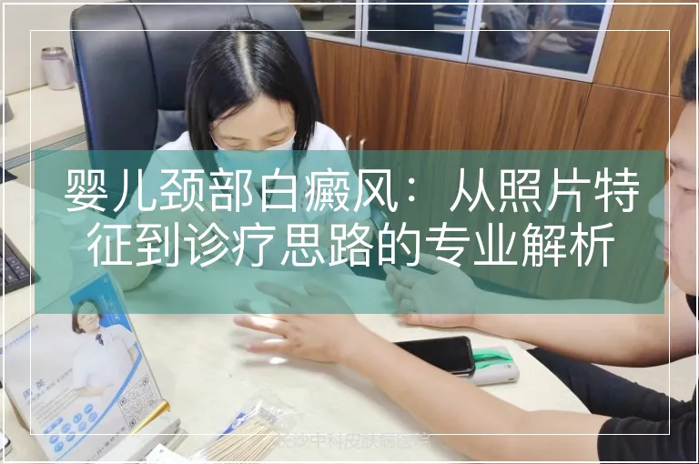 婴儿颈部白癜风：从照片特征到诊疗思路的专业解析