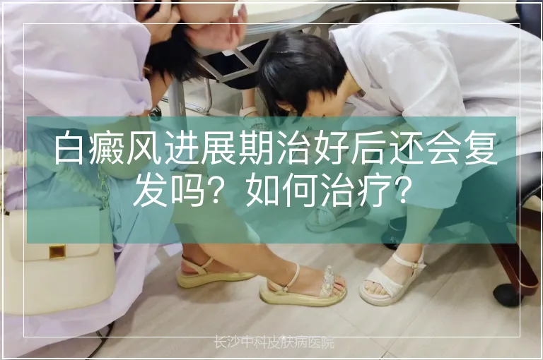 白癜风进展期治好后还会复发吗？如何治疗？