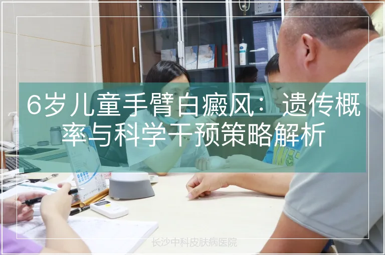 6岁儿童手臂白癜风：遗传概率与科学干预策略解析