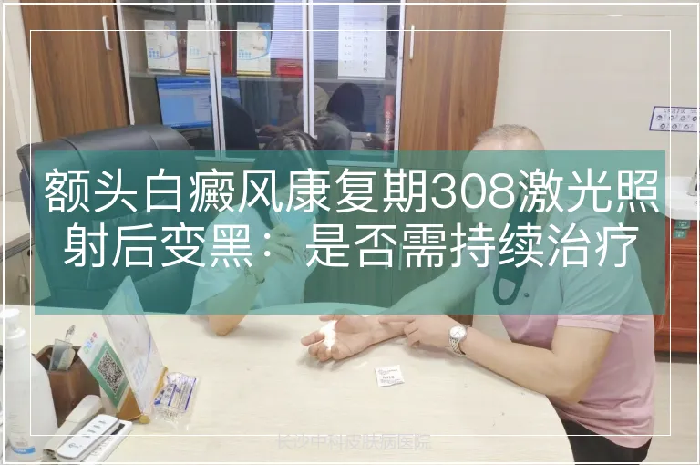 额头白癜风康复期308激光照射后变黑：是否需持续治疗的专业解析
