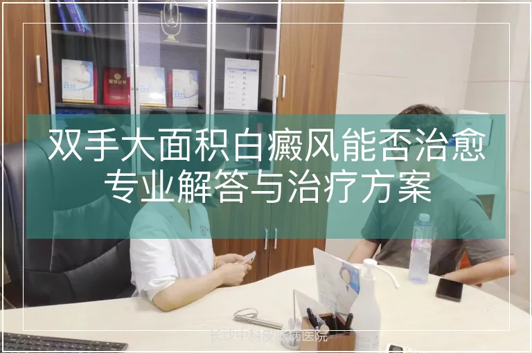 双手大面积白癜风能否治愈专业解答与治疗方案