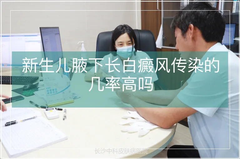 新生儿腋下长白癜风传染的几率高吗