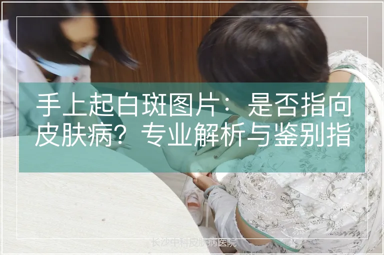 手上起白斑图片：是否指向皮肤病？专业解析与鉴别指南