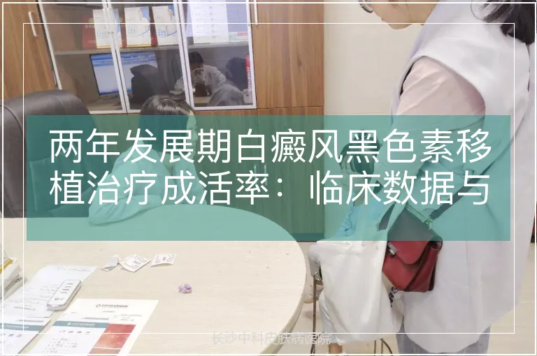 两年发展期白癜风黑色素移植治疗成活率：临床数据与关键影响因素解析