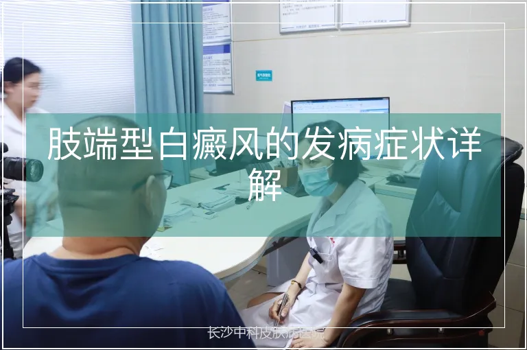 肢端型白癜风的发病症状详解