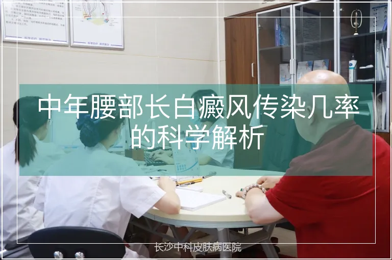 中年腰部长白癜风传染几率的科学解析