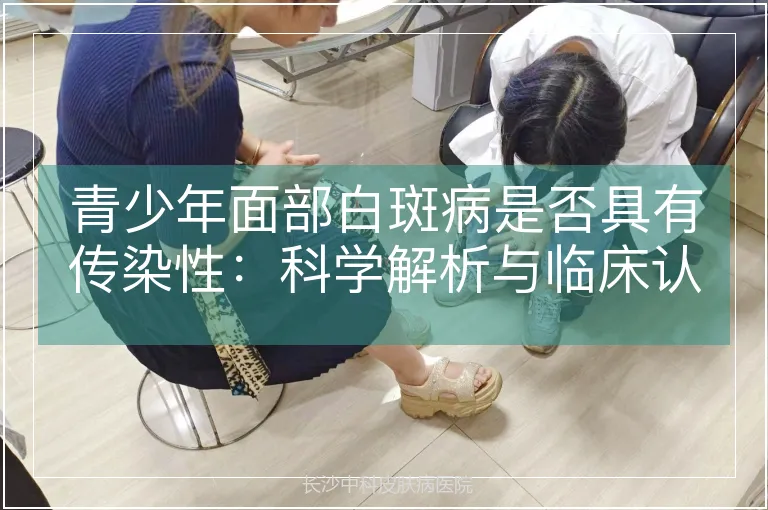 青少年面部白斑病是否具有传染性：科学解析与临床认知