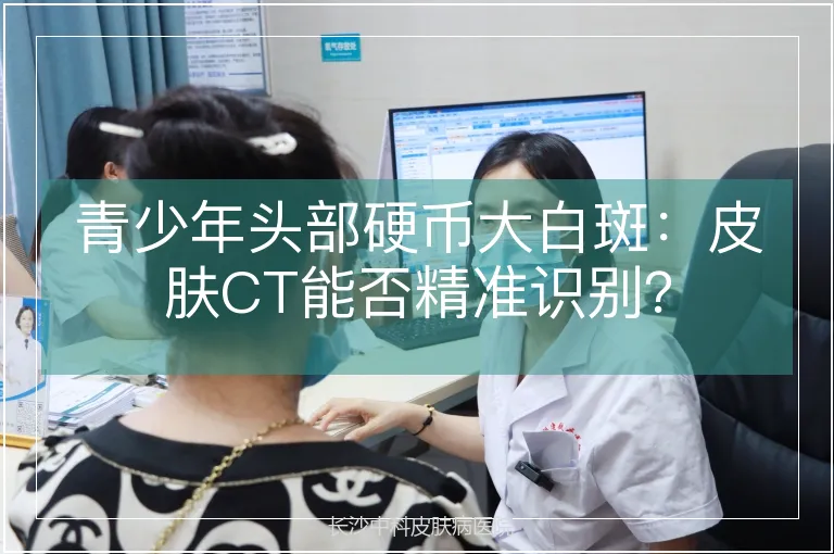 青少年头部硬币大白斑：皮肤CT能否精准识别？