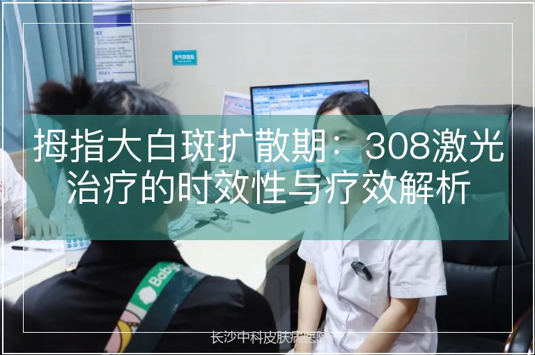 拇指大白斑扩散期：308激光治疗的时效性与疗效解析