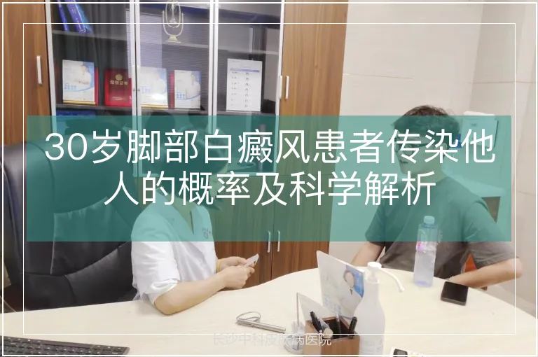 30岁脚部白癜风患者传染他人的概率及科学解析