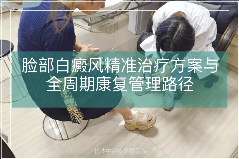 脸部白癜风精准治疗方案与全周期康复管理路径