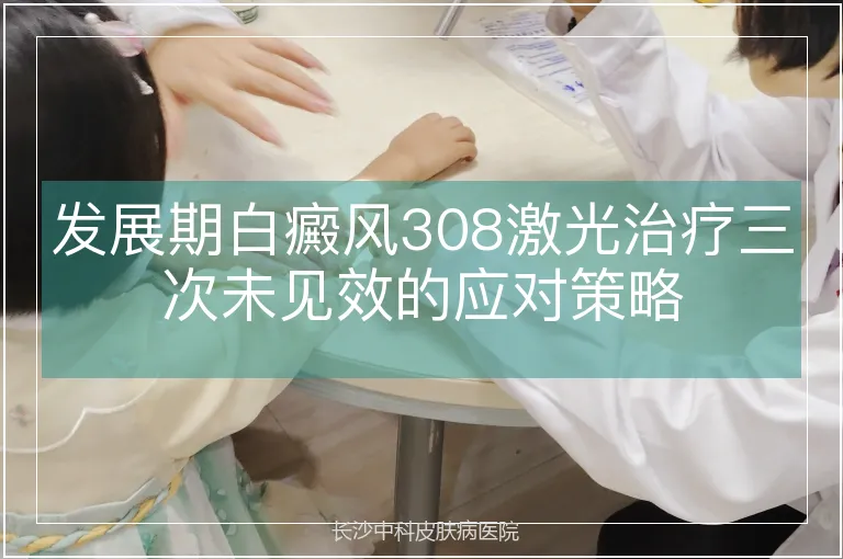 发展期白癜风308激光治疗三次未见效的应对策略