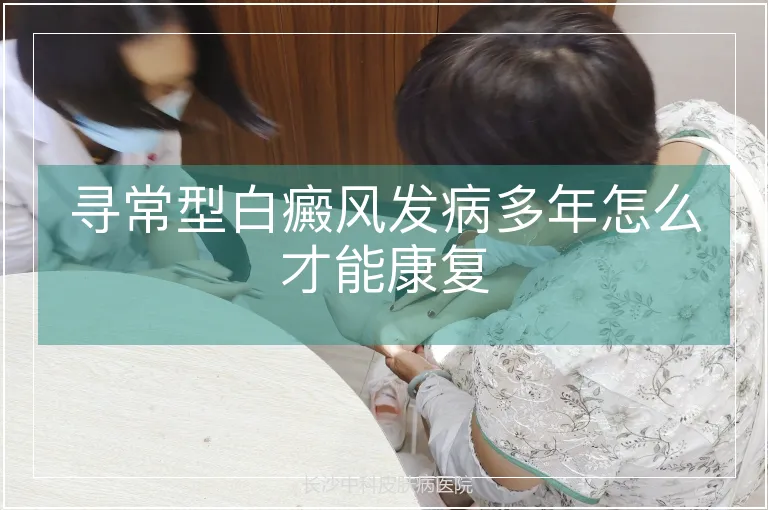 寻常型白癜风发病多年怎么才能康复