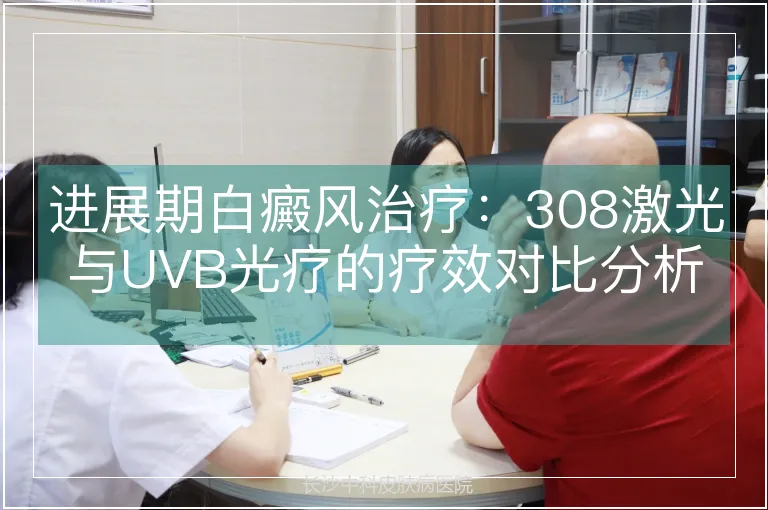进展期白癜风治疗：308激光与UVB光疗的疗效对比分析